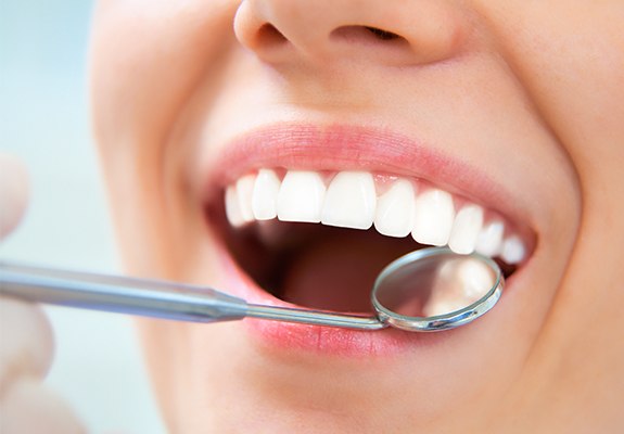 Closeup of healthy smile