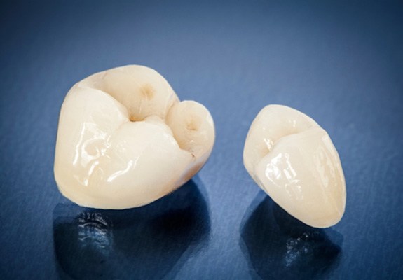 Two dental crowns sitting on reflective surface
