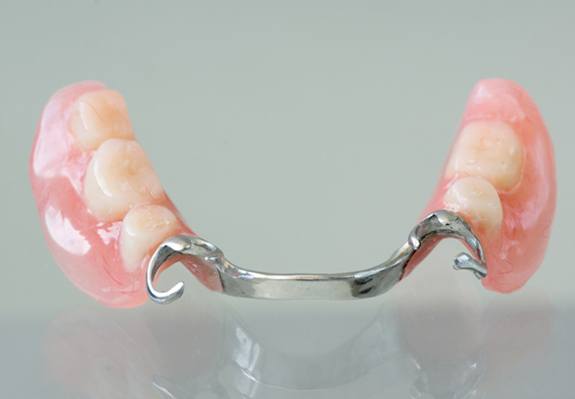 A partial denture