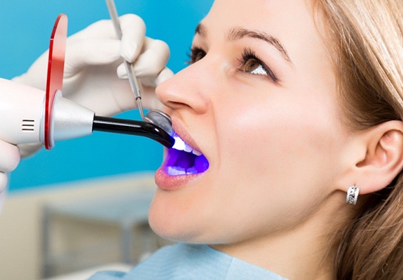dentist direct bonding a patient’s teeth