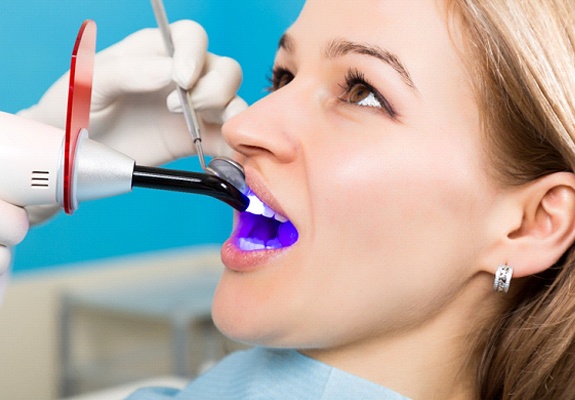 Dental Bonding Benefits for Tooth Repair - Perkins Dental Care