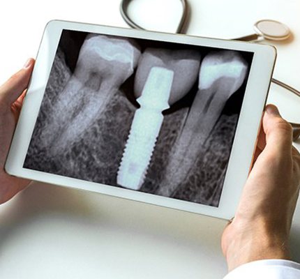 A dentist holding a tablet displaying an X-ray