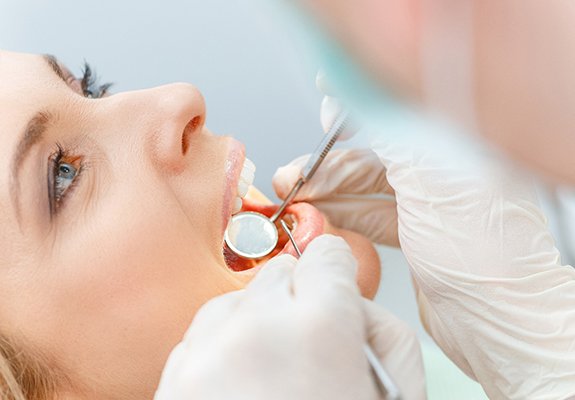 dental checkup
