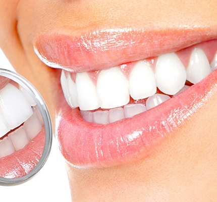 Whiter smile