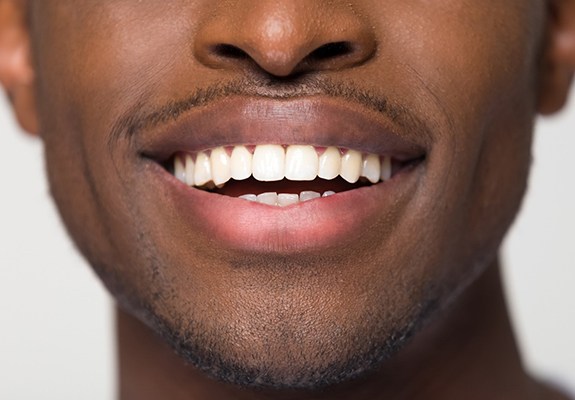 Man with beautiful teeth after teeth whitening in Farwood, NJ