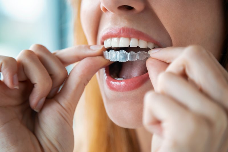 young woman putting on her Invisalign aligner